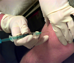 Vaccine-in-leg